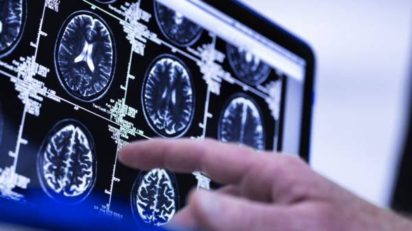 Dementia: Novel brain scan may predict age-related disease