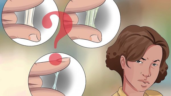 Выделения после секса&nbsp;&mdash; опасно ли?