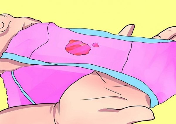 Выделения после секса&nbsp;&mdash; опасно ли?